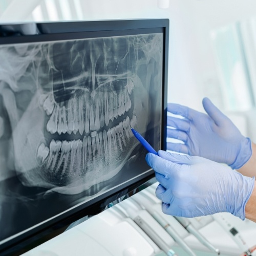 Dentist pointing to screen showing x rays of teeth