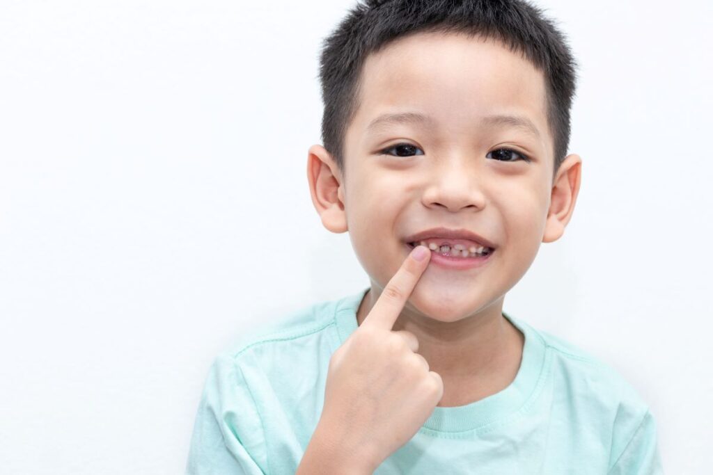 A little boy pointing to his missing tooth site.